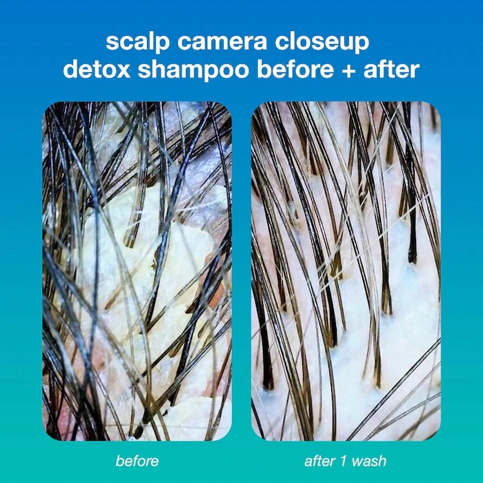 Peptide Prep Detox Shampoo